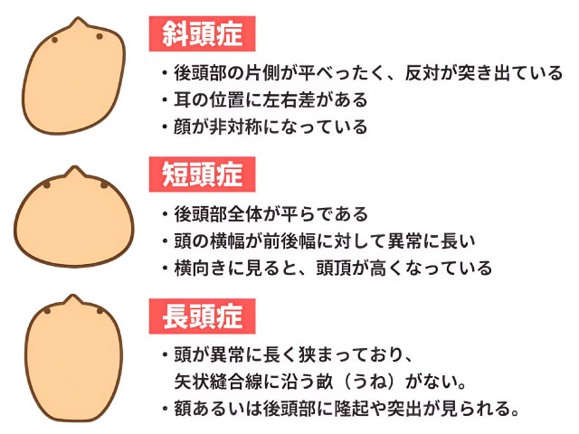 松戸市 整体,ふくます整体院,妊活,頭痛,ダイエット,起立性調節障害